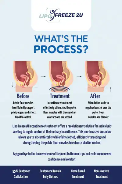 Diagram of how incontinence treatment Lincoln works.