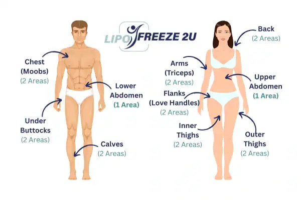 Areas you can have fat freezing treatment Lincoln
