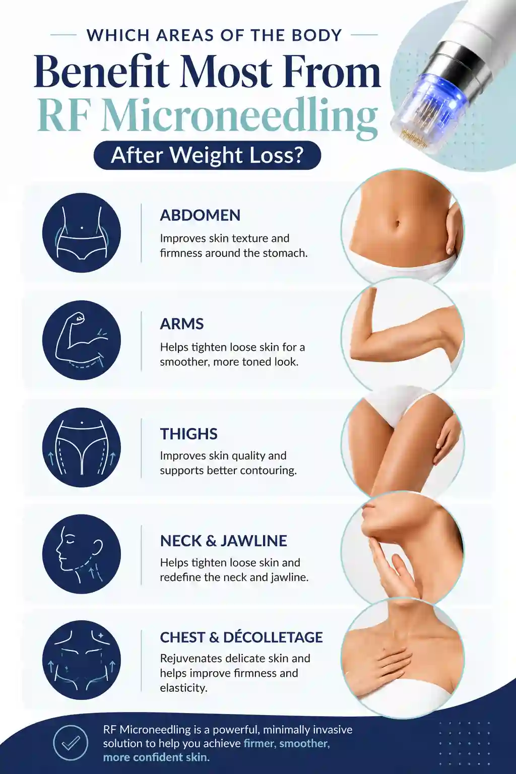 Which Areas of the Body Benefit Most From RF Microneedling After Weight Loss Lincoln